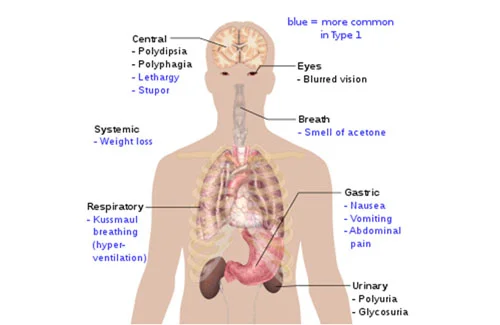 diabetes-doctor